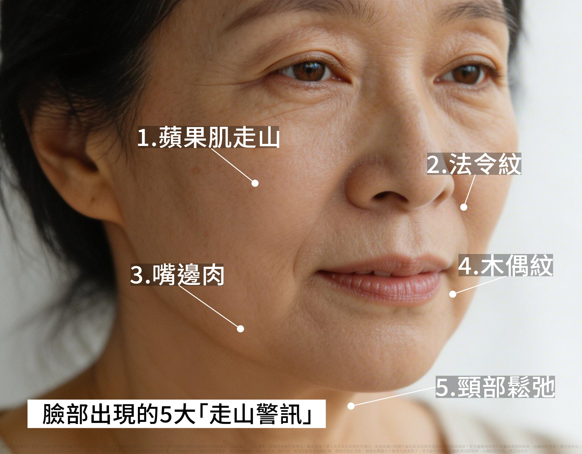 臉部5大走山警訊