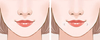 什麼是酒窩/梨渦