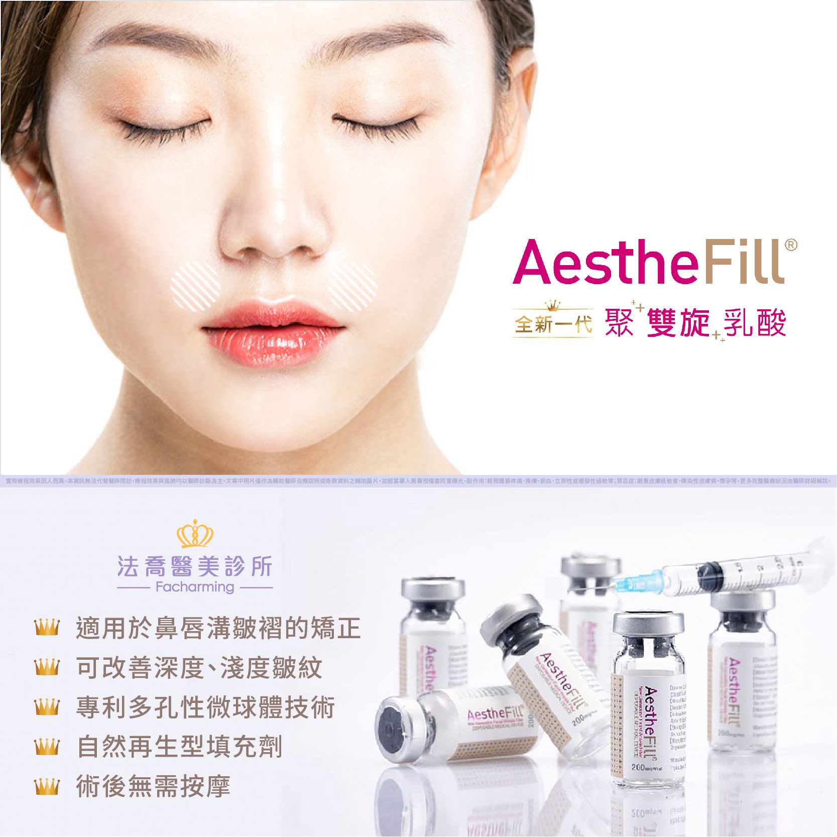 AestheFill® 艾麗斯