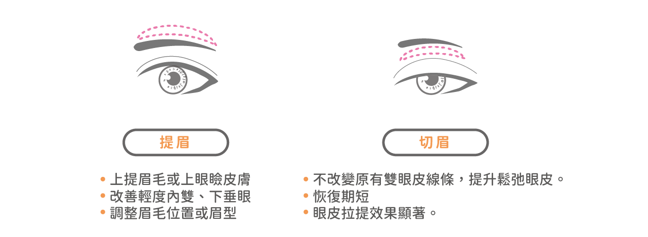 提眉及切眉的差異