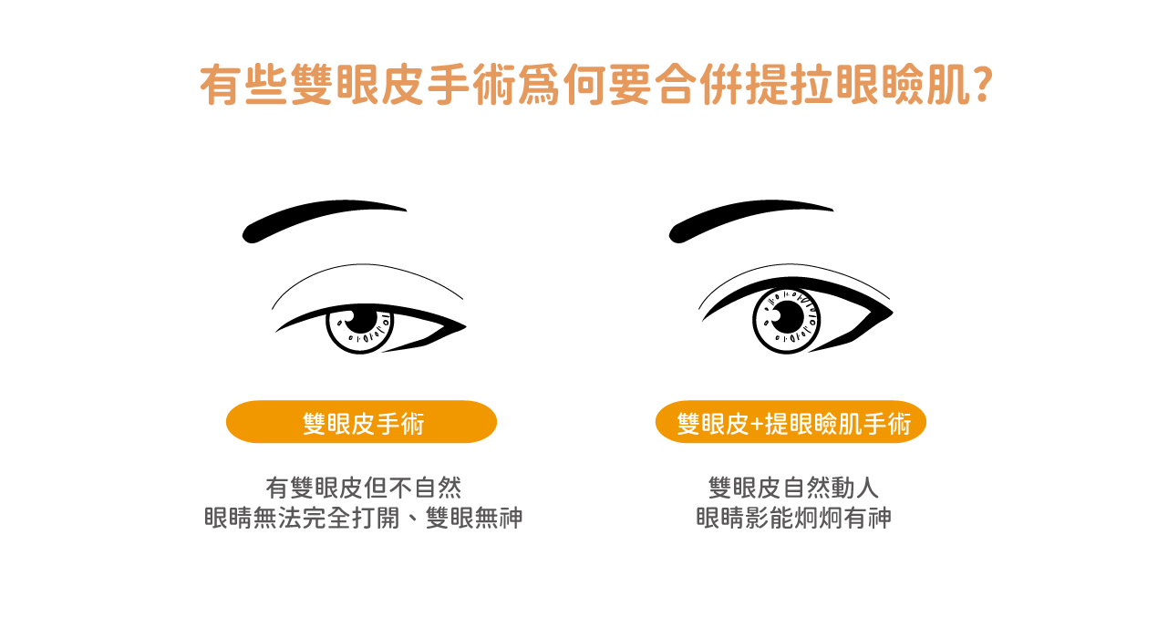 為何要做提眼瞼肌手術