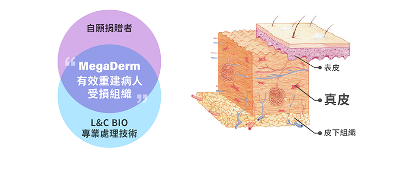 異體真皮來源說明圖