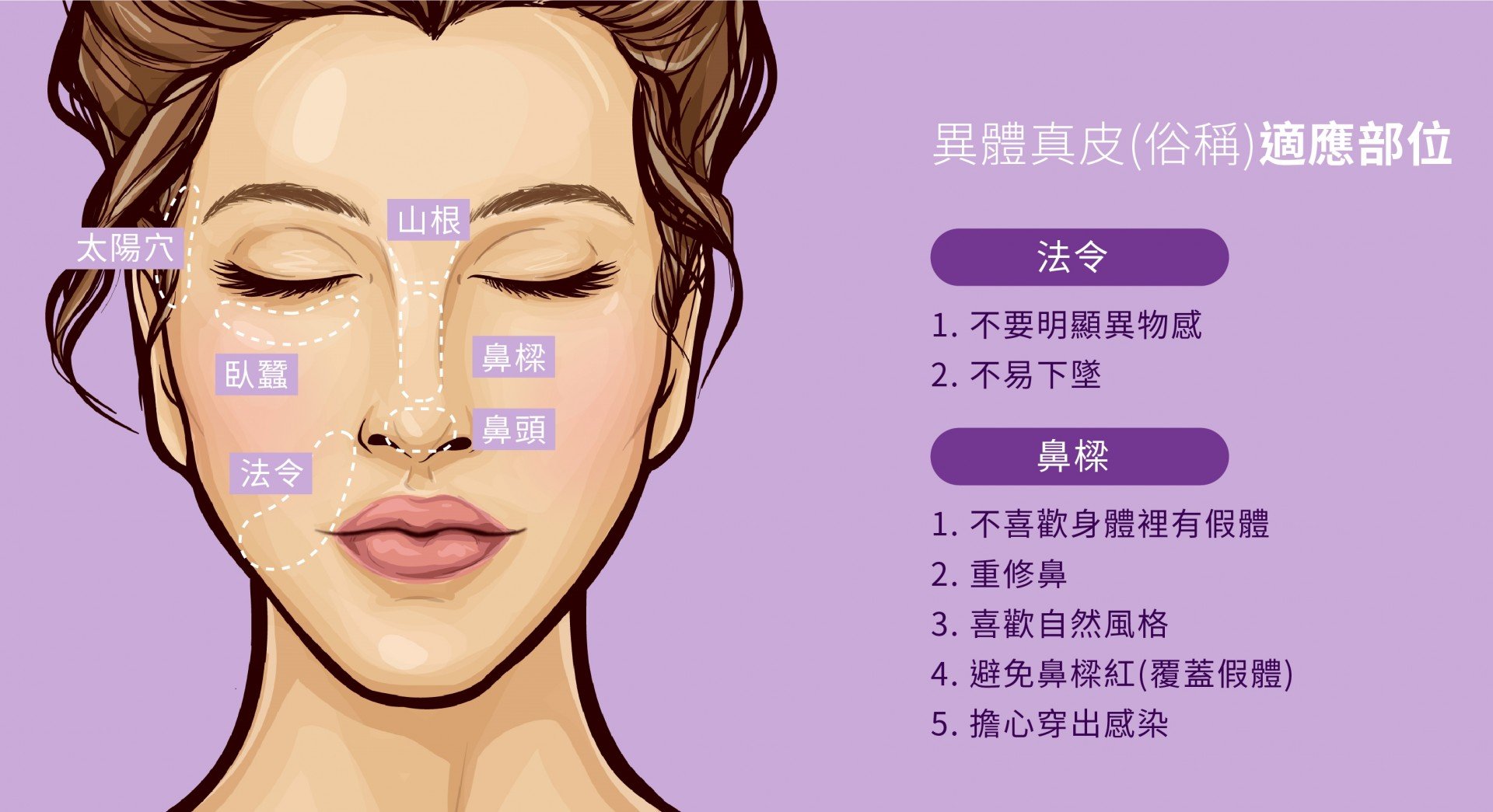 異體真皮臉部適應部位