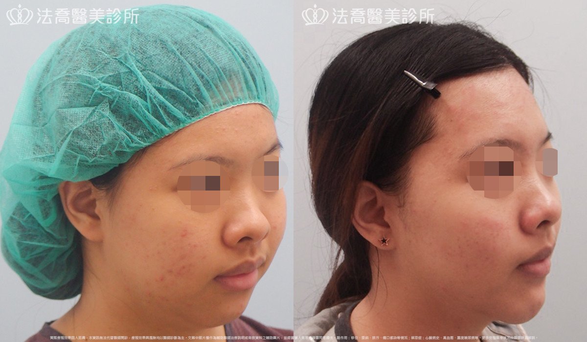 法喬醫美診所 邱浚彥醫師