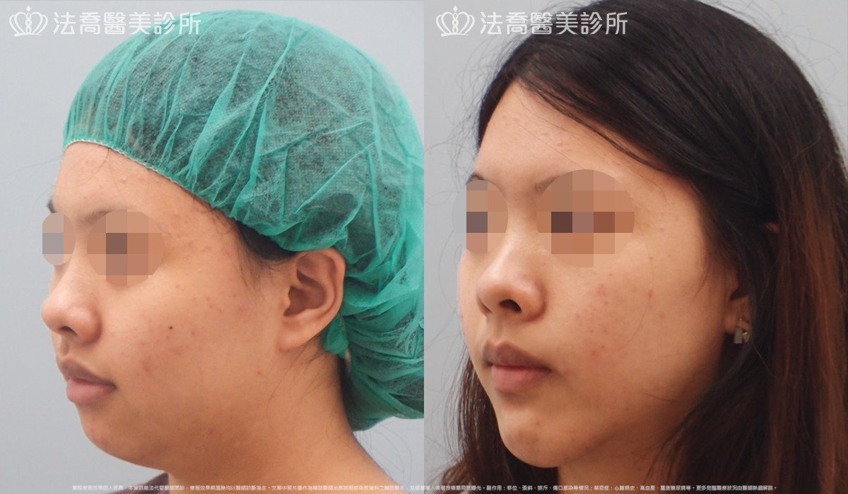 法喬醫美診所 邱浚彥醫師