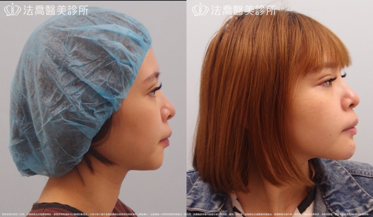 法喬醫美診所 邱浚彥醫師