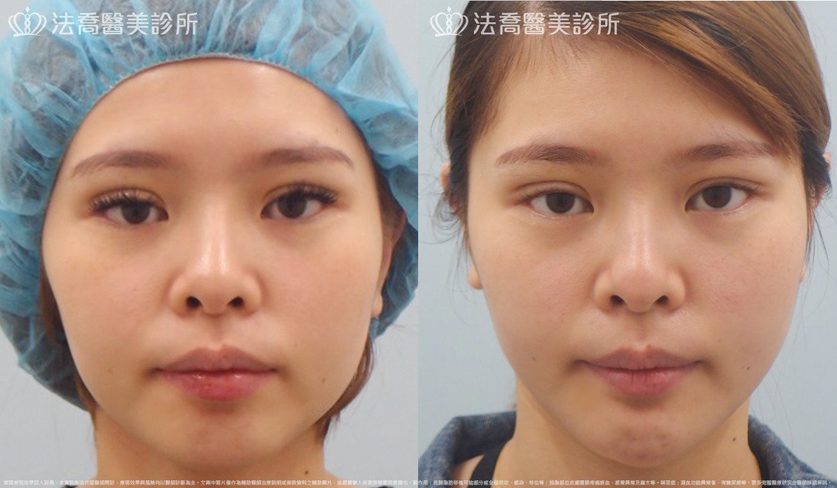 法喬醫美診所 邱浚彥醫師