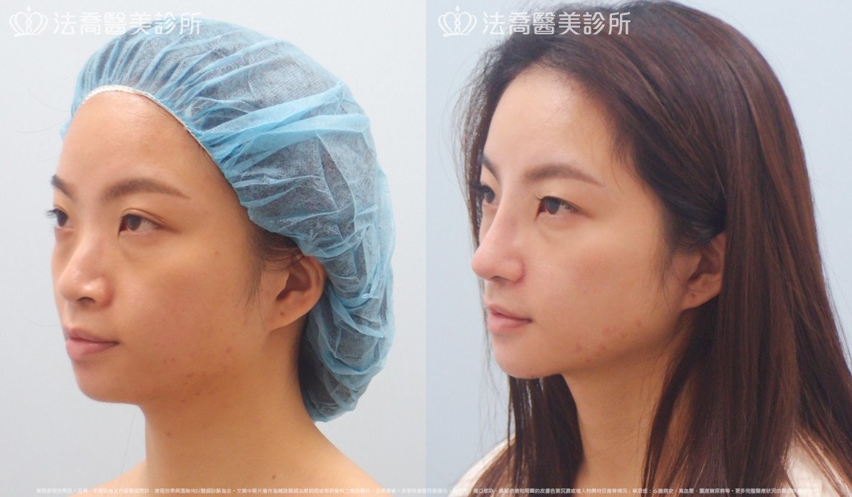 法喬醫美診所 邱浚彥醫師