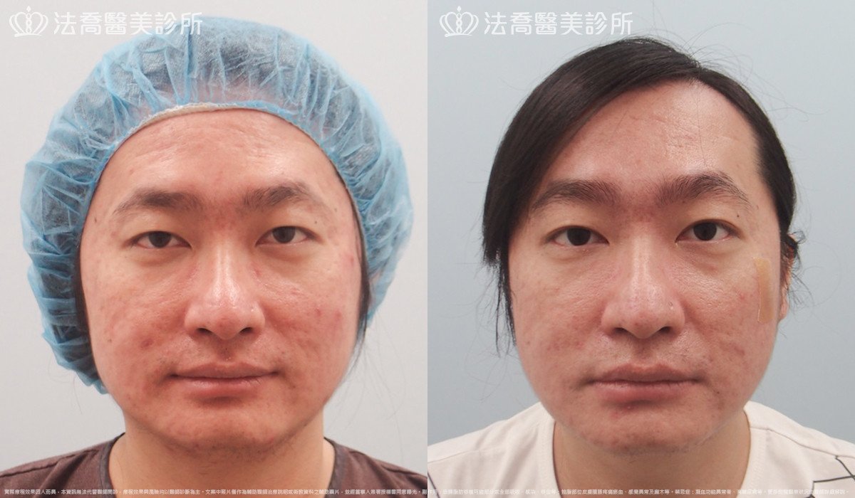 法喬醫美診所 邱浚彥醫師