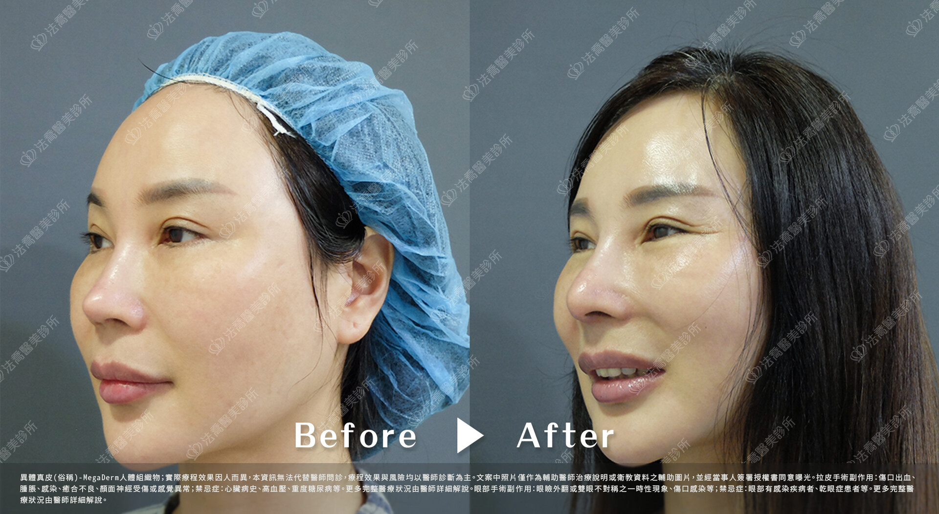 法喬醫美診所 邱浚彥醫師