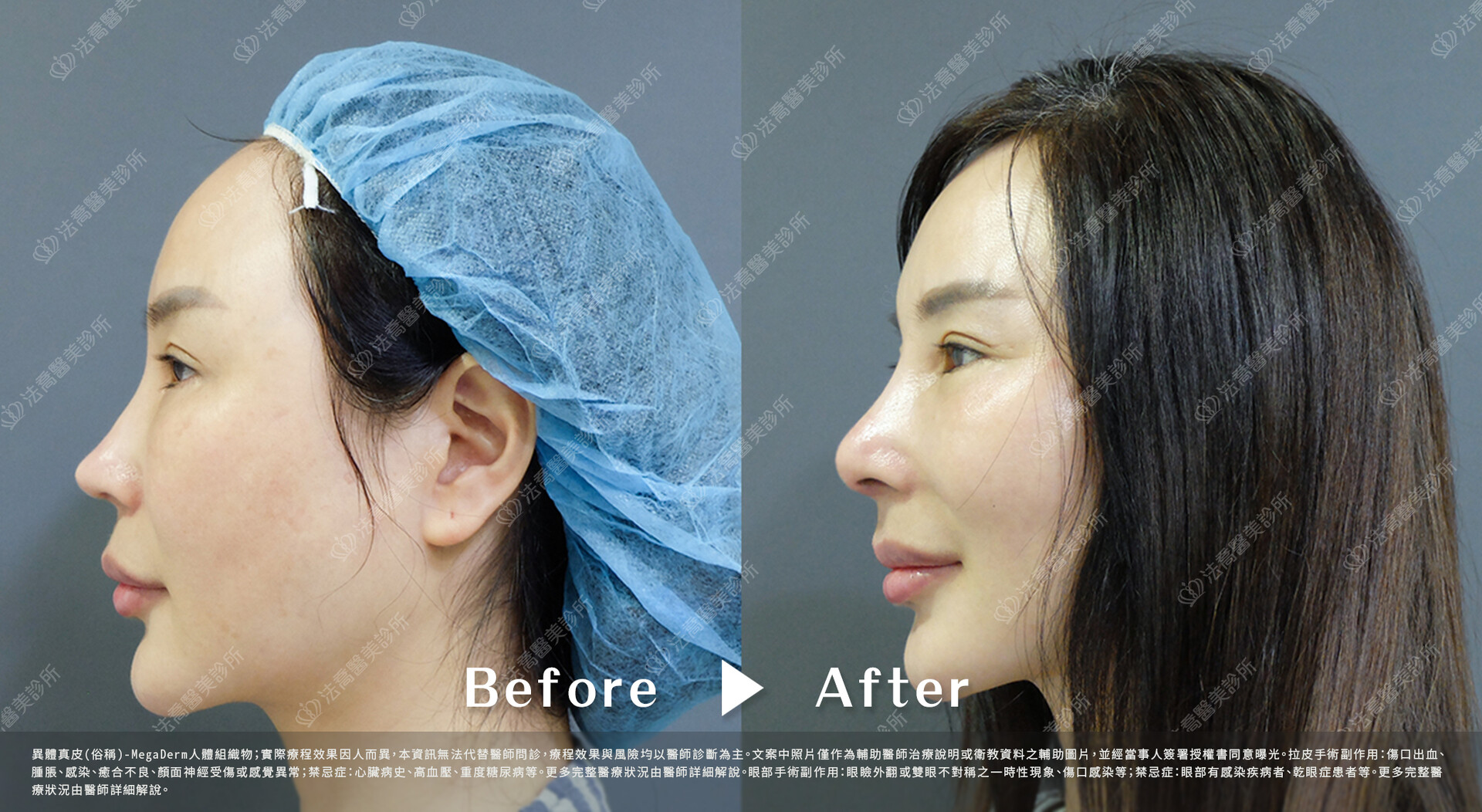 法喬醫美診所 邱浚彥醫師