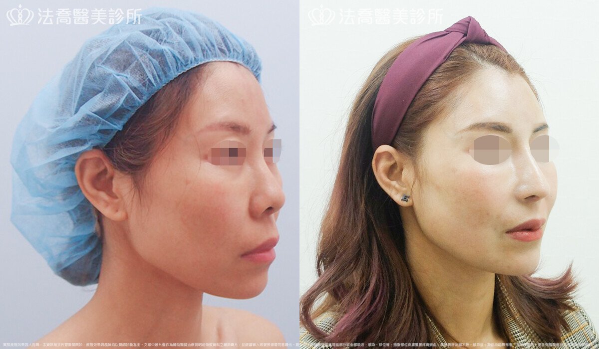 法喬醫美診所 邱浚彥醫師