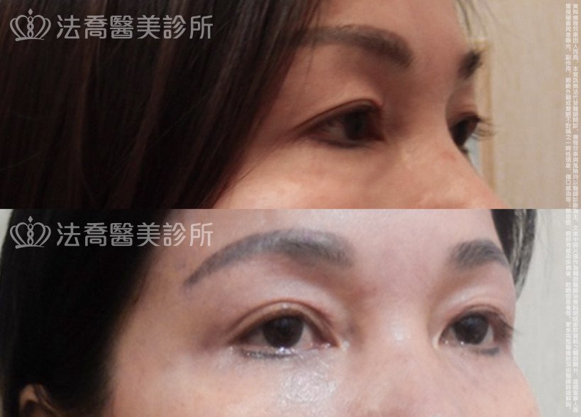 法喬醫美診所 邱浚彥醫師