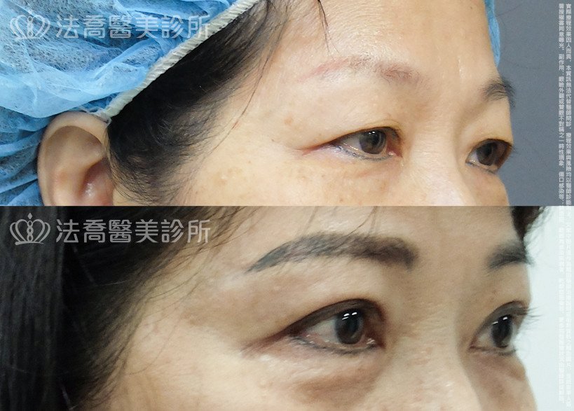 法喬醫美診所 邱浚彥醫師