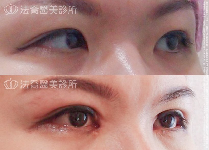 法喬醫美診所 邱浚彥醫師