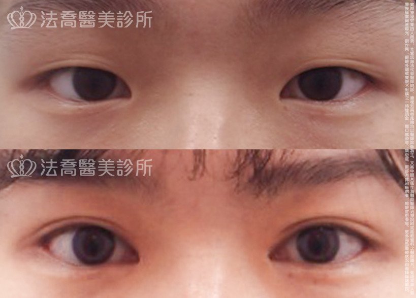 法喬醫美診所 邱浚彥醫師