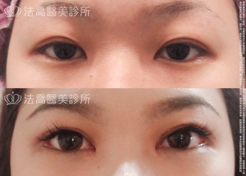 法喬醫美診所 邱浚彥醫師