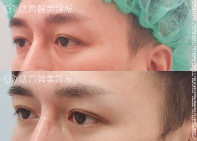 法喬醫美診所 邱浚彥醫師