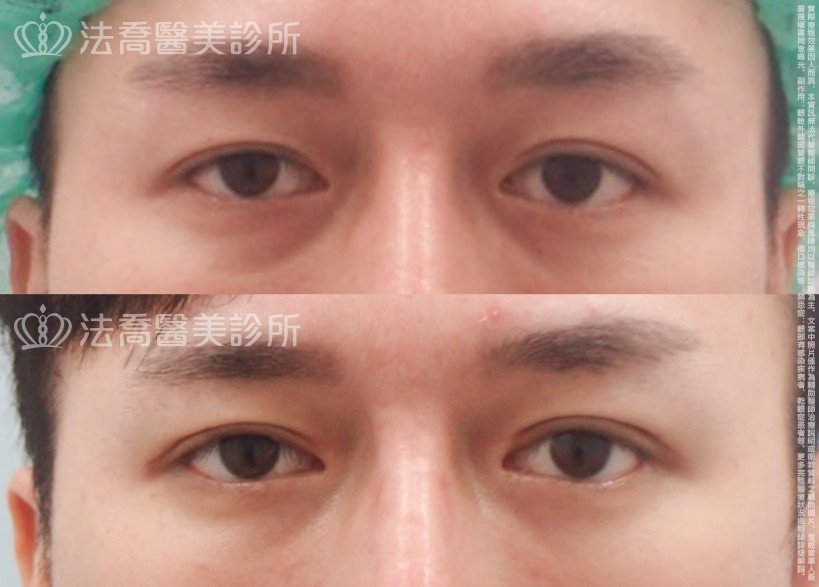 法喬醫美診所 邱浚彥醫師