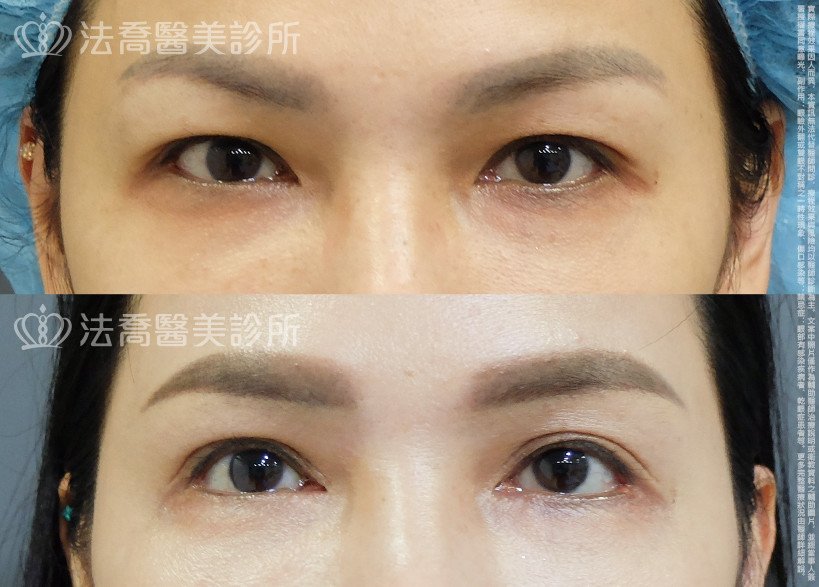 法喬醫美診所 邱浚彥醫師