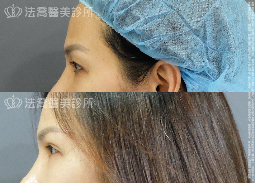 法喬醫美診所 邱浚彥醫師