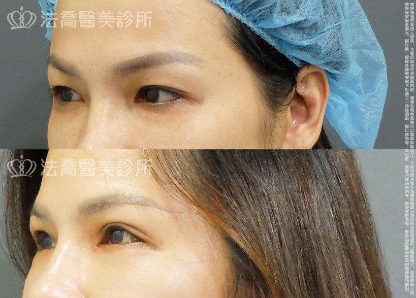 法喬醫美診所 邱浚彥醫師