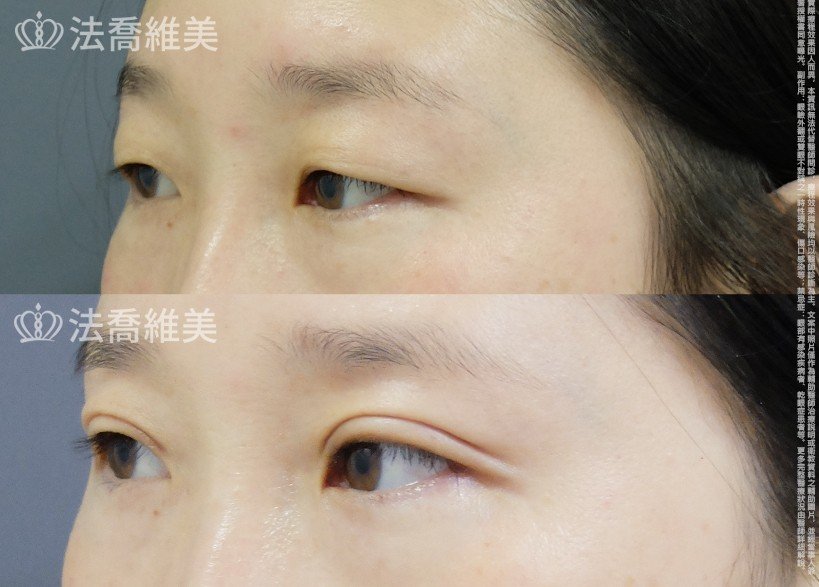 法喬維美醫美診所