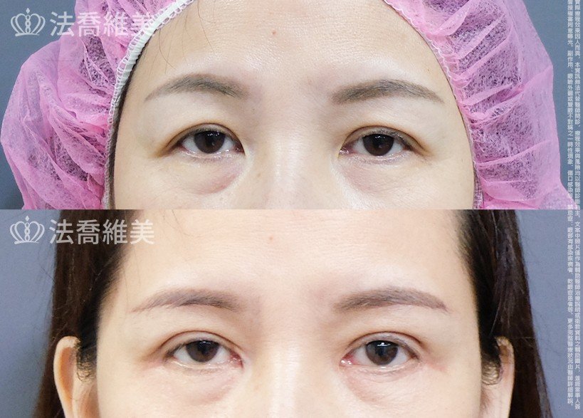 法喬維美醫美診所