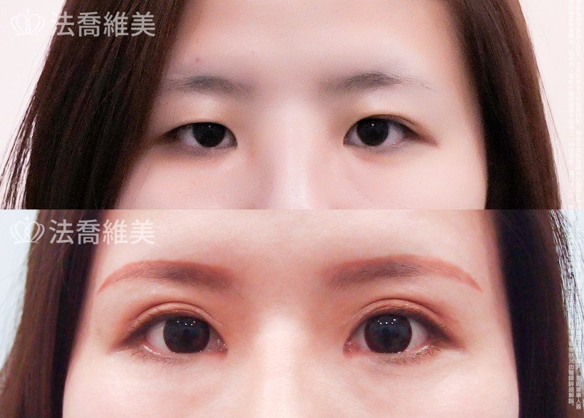 法喬維美醫美診所