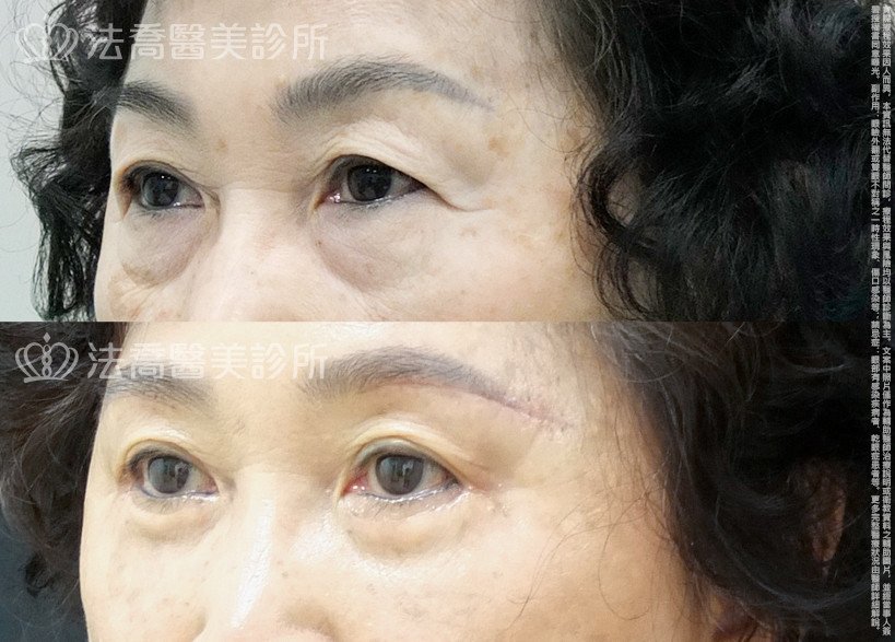 法喬醫美診所 邱浚彥醫師