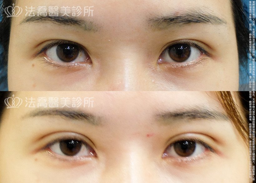 法喬醫美診所 邱浚彥醫師