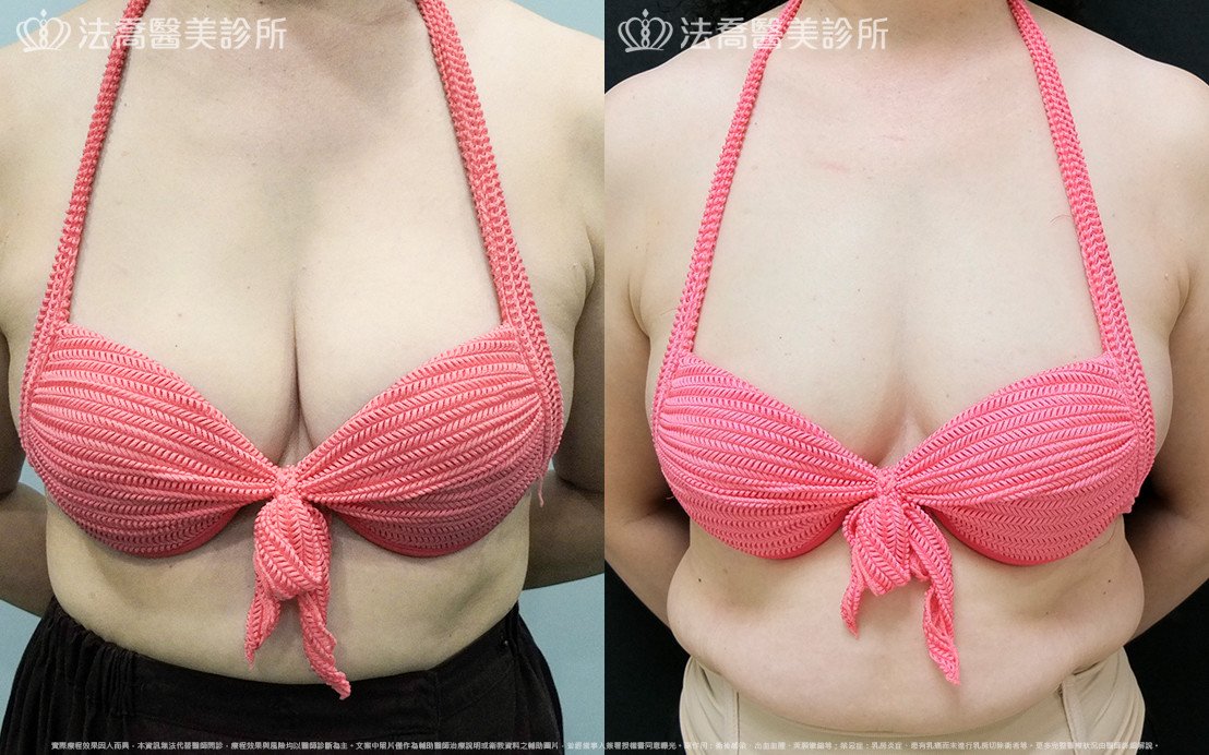 法喬醫美診所 邱浚彥醫師