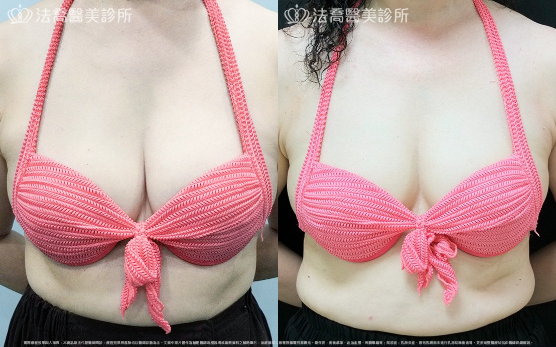 法喬醫美診所 邱浚彥醫師