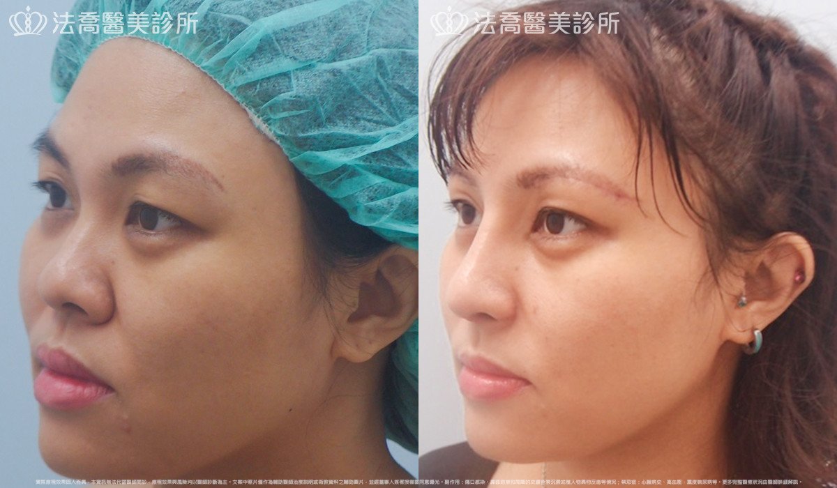 法喬醫美診所 邱浚彥醫師