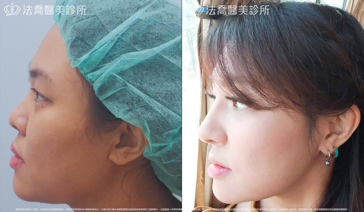 法喬醫美診所 邱浚彥醫師