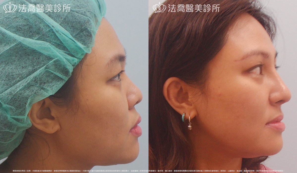 法喬醫美診所 邱浚彥醫師