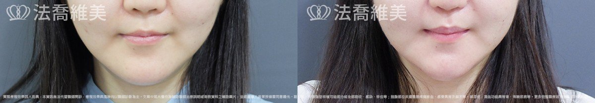 法喬維美醫美診所