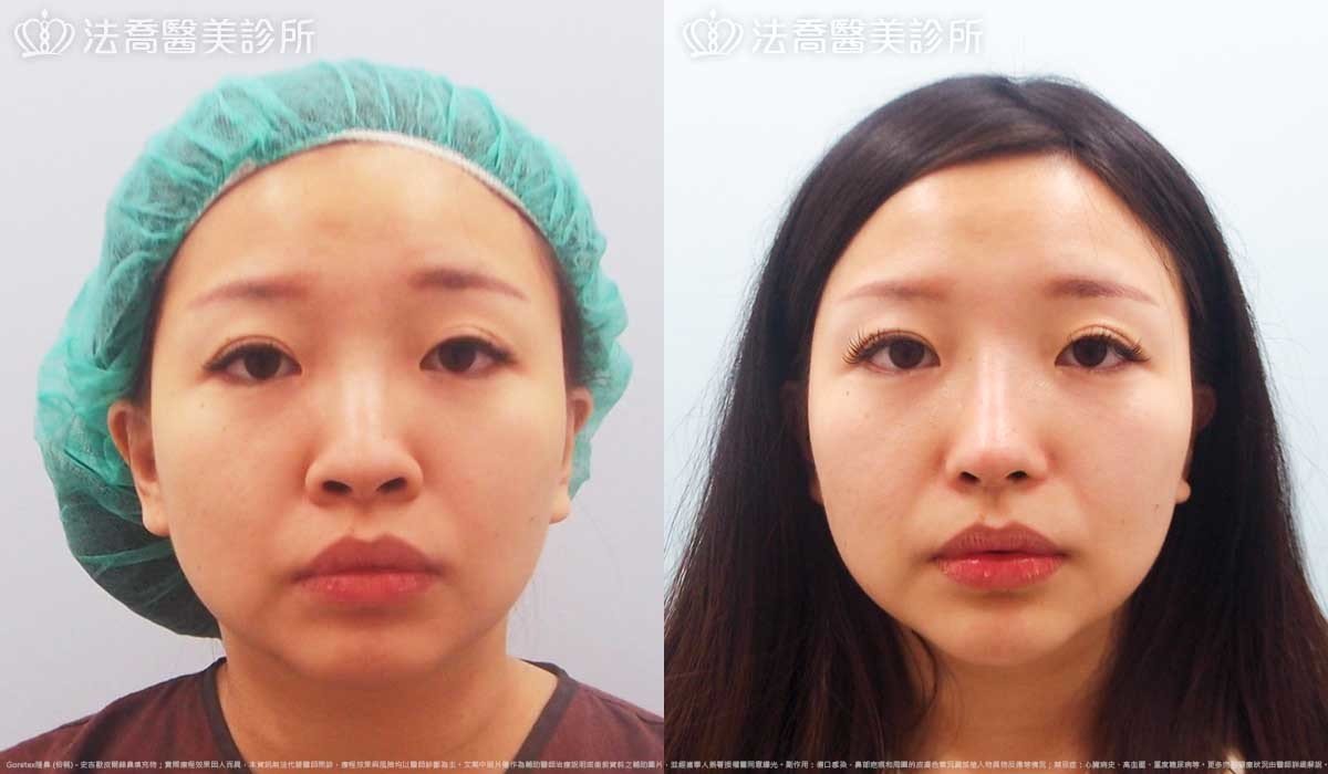 法喬醫美診所,邱浚彥
