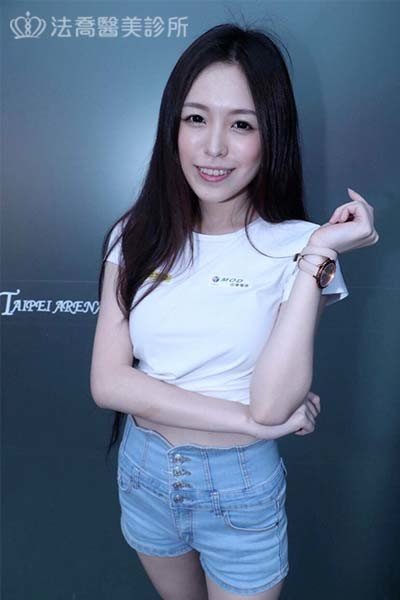 自體肋骨隆鼻