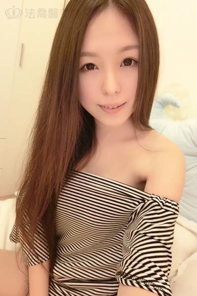 自體肋骨隆鼻