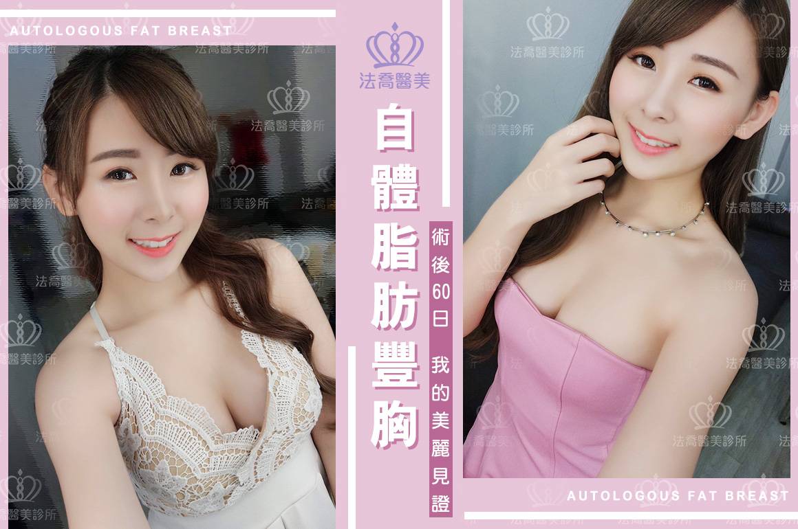 法喬醫美診所-自體脂肪豐胸