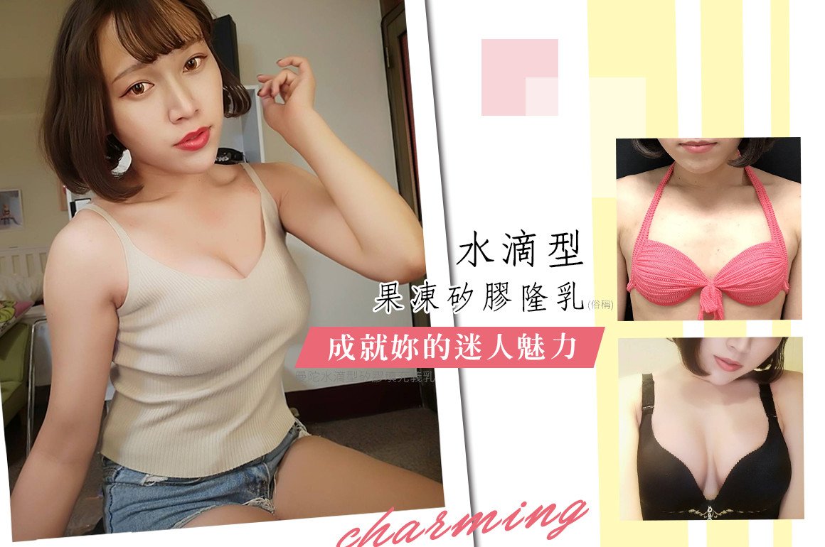 法喬醫美診所隆乳案例