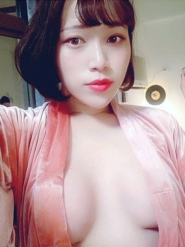 法喬邱浚彥隆乳術後6個月案例照