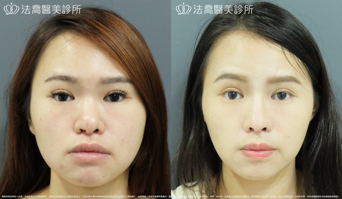 法喬醫美診所 邱浚彥醫師