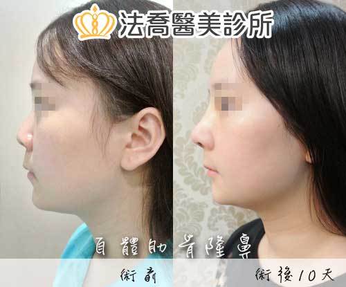 法喬醫美診所 邱浚彥醫師