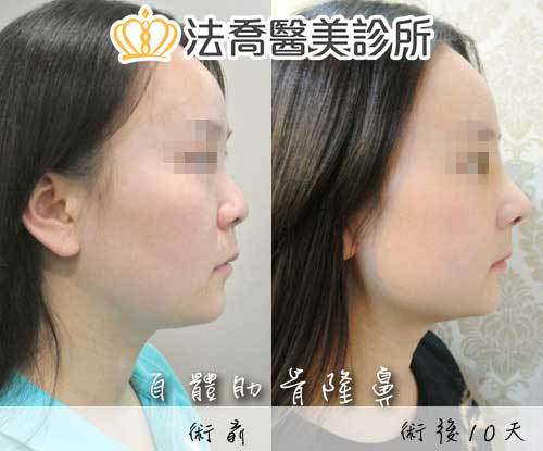 法喬醫美診所 邱浚彥醫師