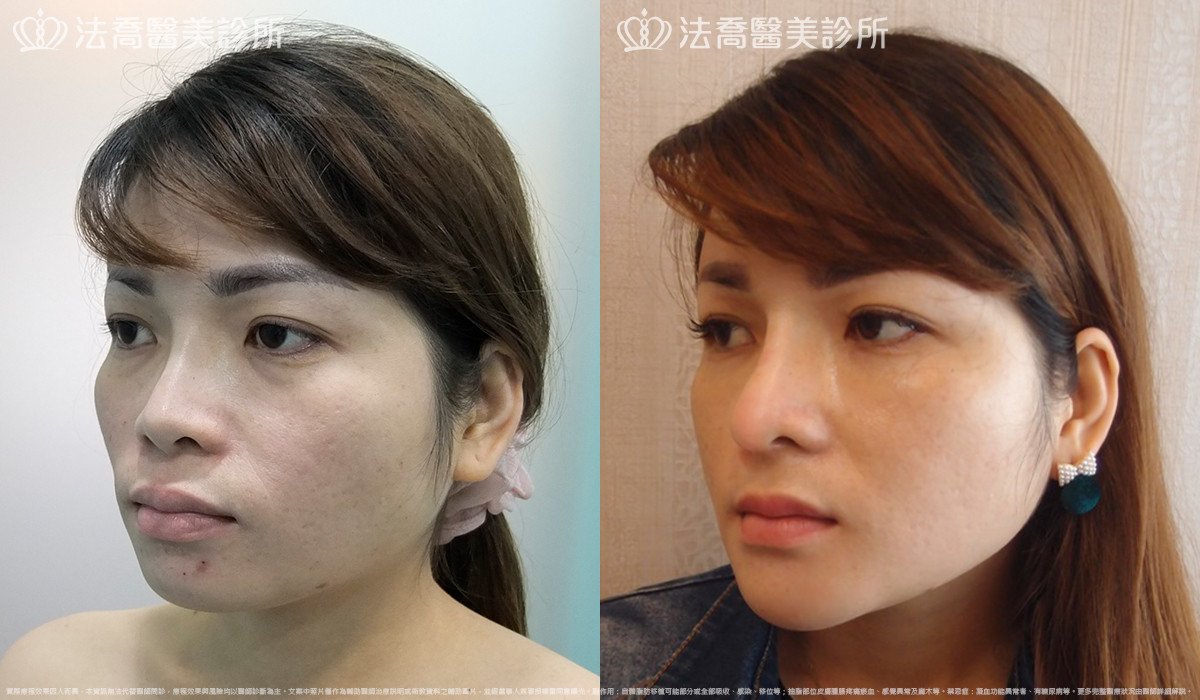 法喬醫美診所 邱浚彥醫師