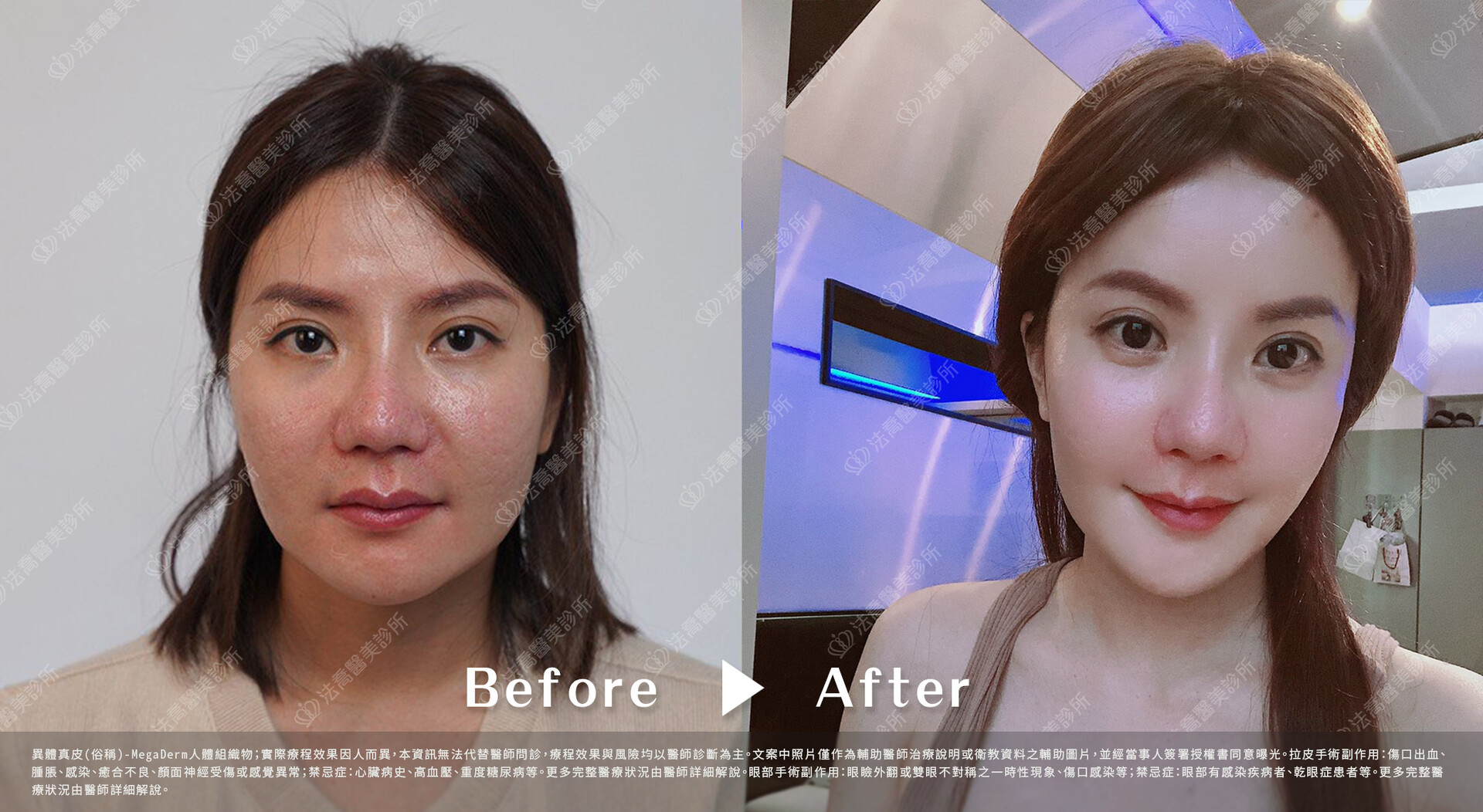 法喬醫美診所 邱浚彥醫師