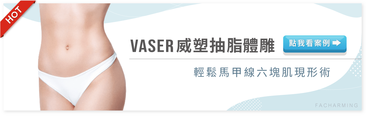 VASER威塑抽脂,大腿環抽 法喬醫美診所 VASER威塑抽脂,大腿環抽