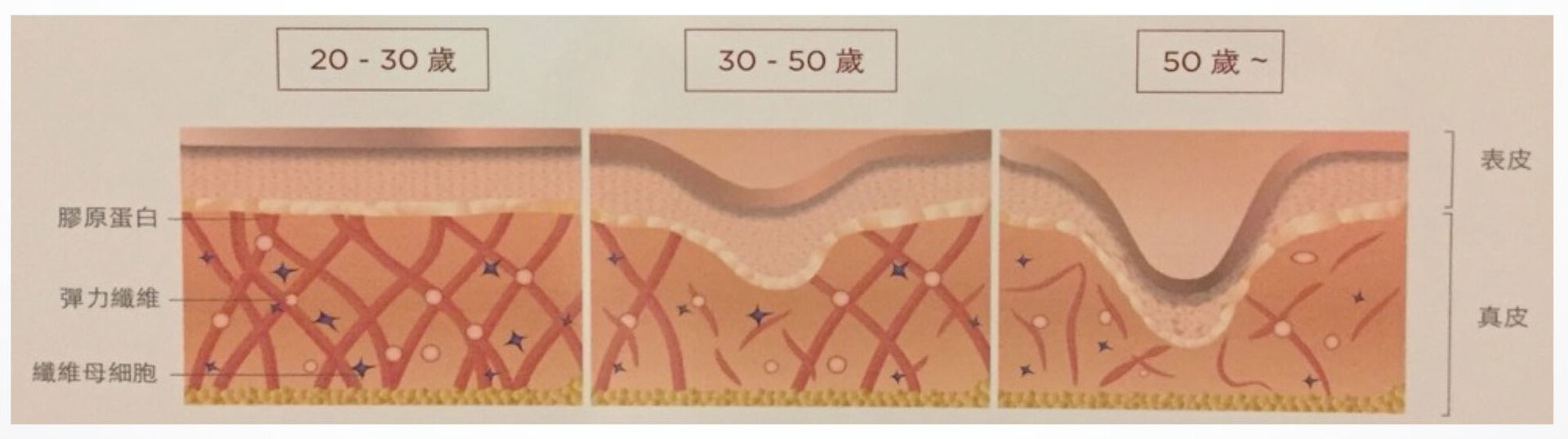 台中精靈針老化的肌膚問題